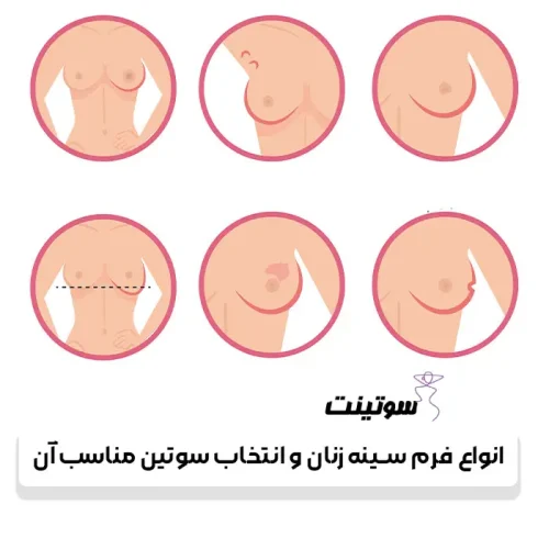 انواع فرم سينه زنان و انتخاب سوتین مناسب آن