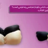 سوتین مناسب لباس جلو باز مجلسی چه نوعی است؟ راهنمای بهترین انتخاب